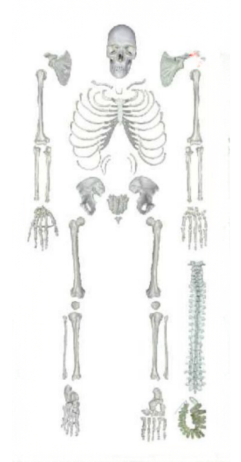 Disarticulated Skeleton