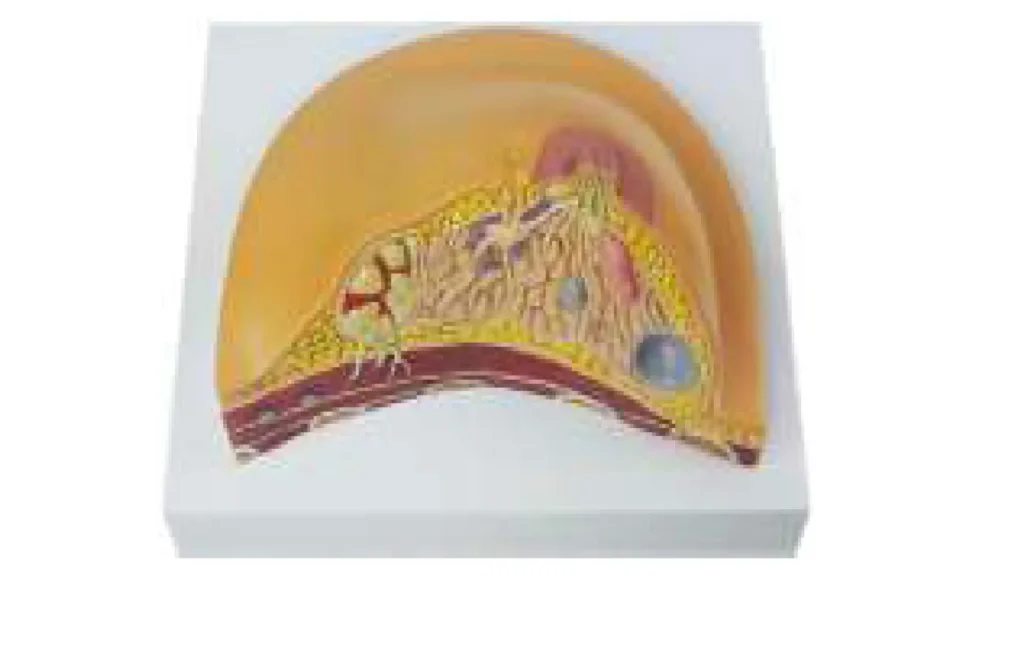 breast pathologies model