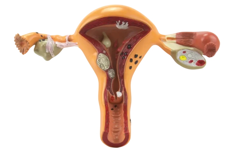 Ovary Model