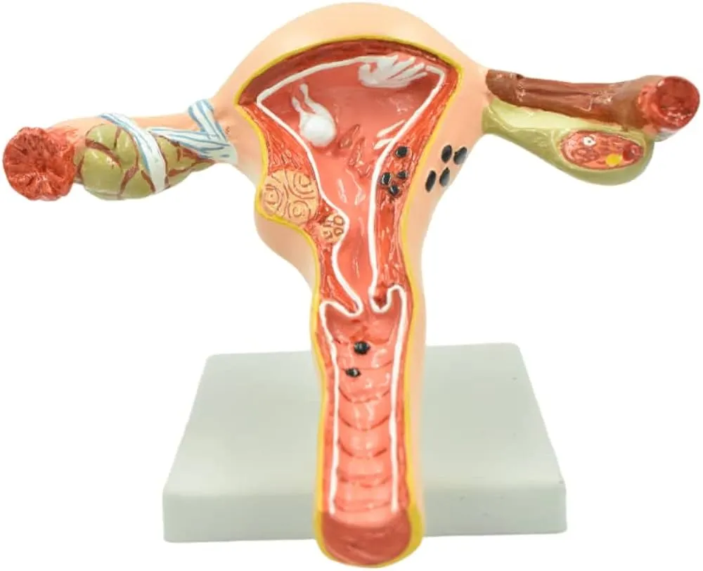ovary model