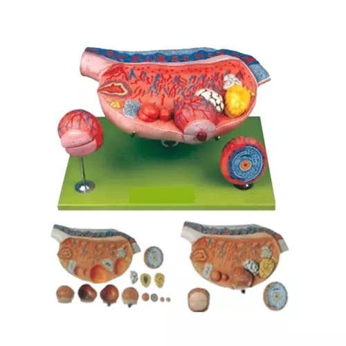breast pathologies model