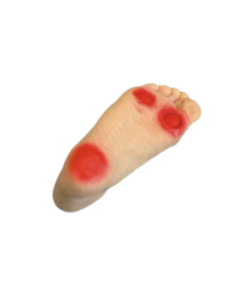Foot ulcer training model