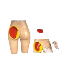 Nursing injection practice model.