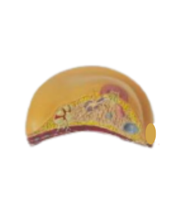 breast pathologies model