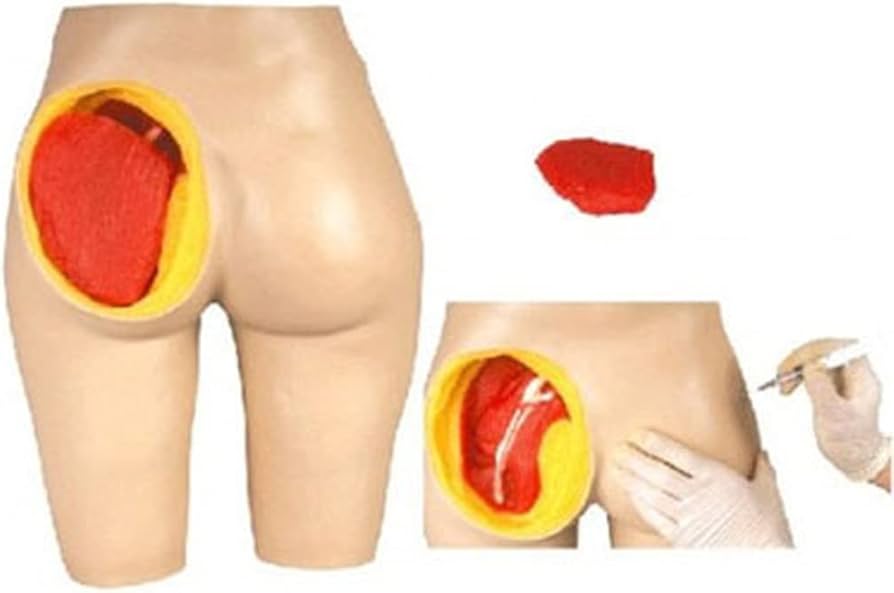 Nursing injection practice model.